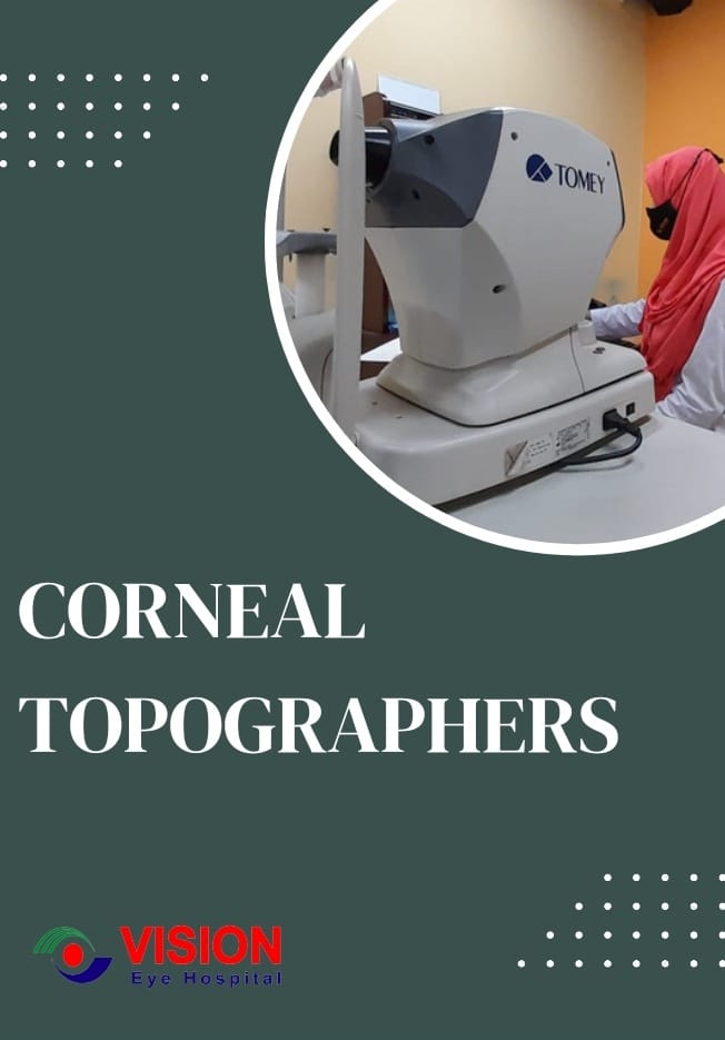 Corneal Topography Corneal Topography