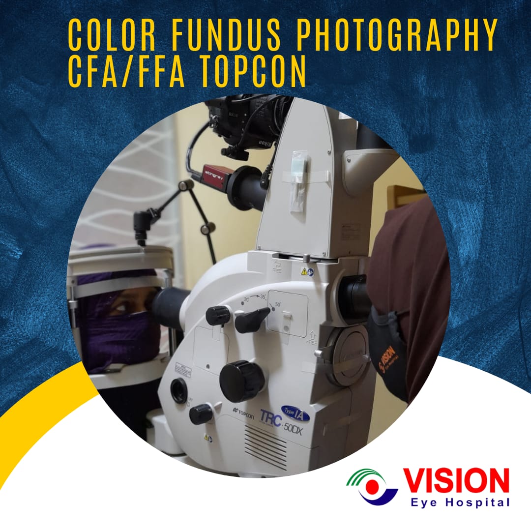 Color Fundus Photography CFA-FFA Topcon Color Fundus Photography CFA-FFA Topcon