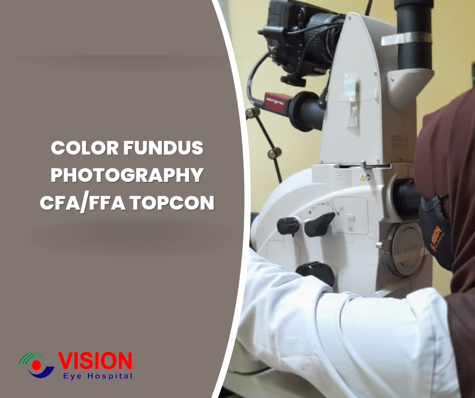 Color Fundus Photography CFA-FFA Topcon Color Fundus Photography CFA-FFA Topcon
